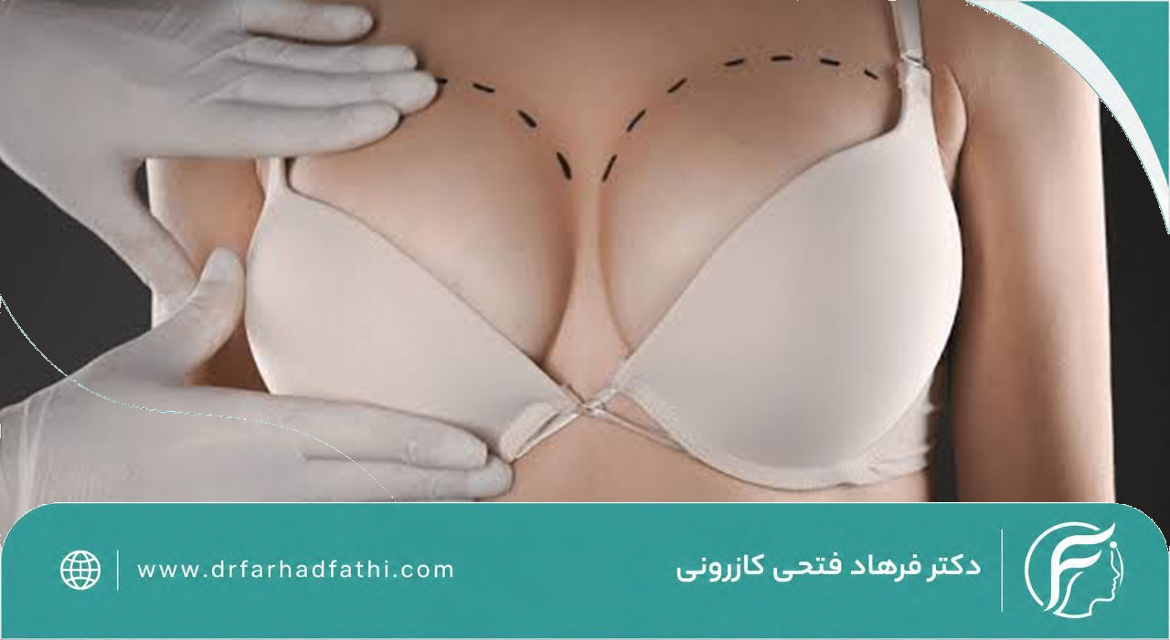 روش های لیفت سینه