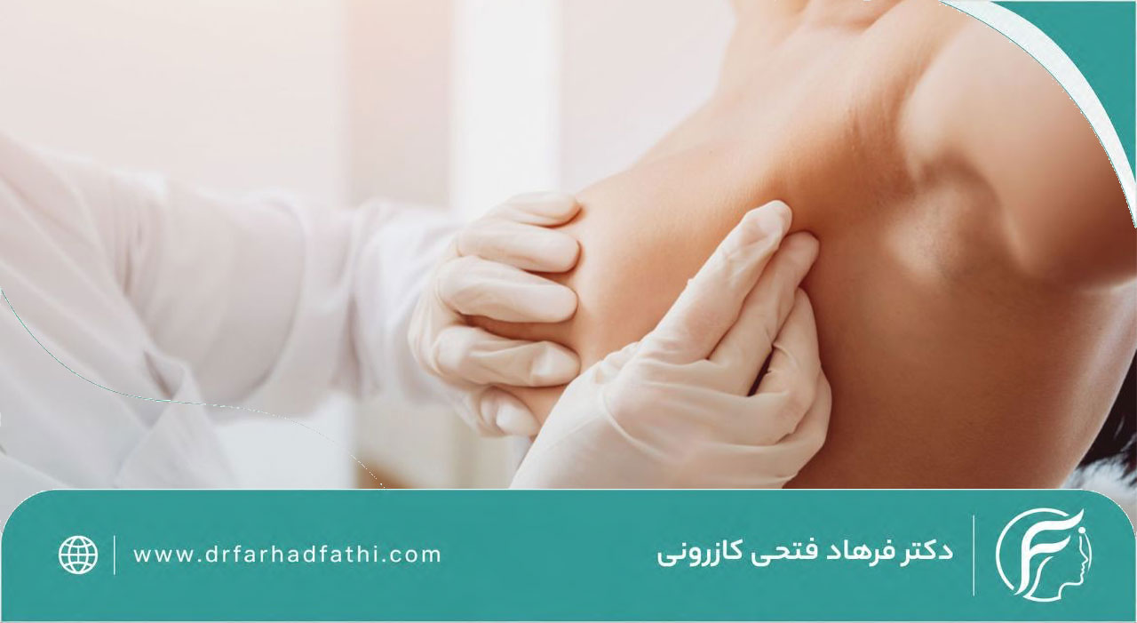 روش های ماموپلاستی