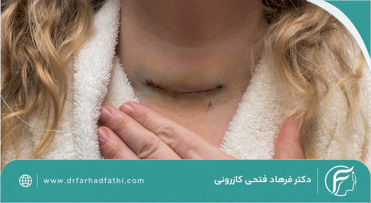 مراقبت های بعداز عمل تیروئید