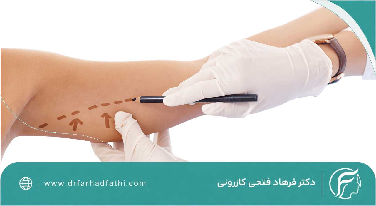 عوارض لیفت بازو