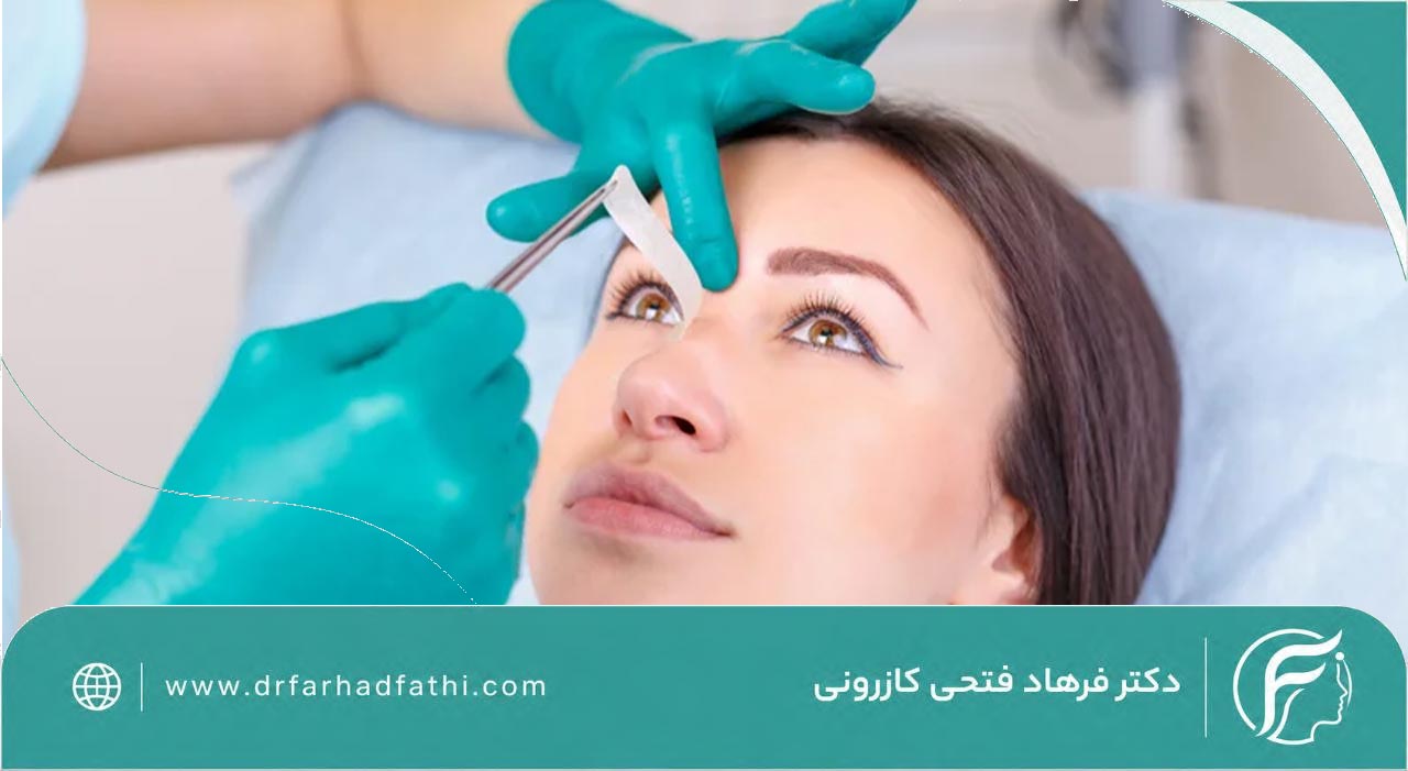 مراحل انجام بلفاروپلاستی