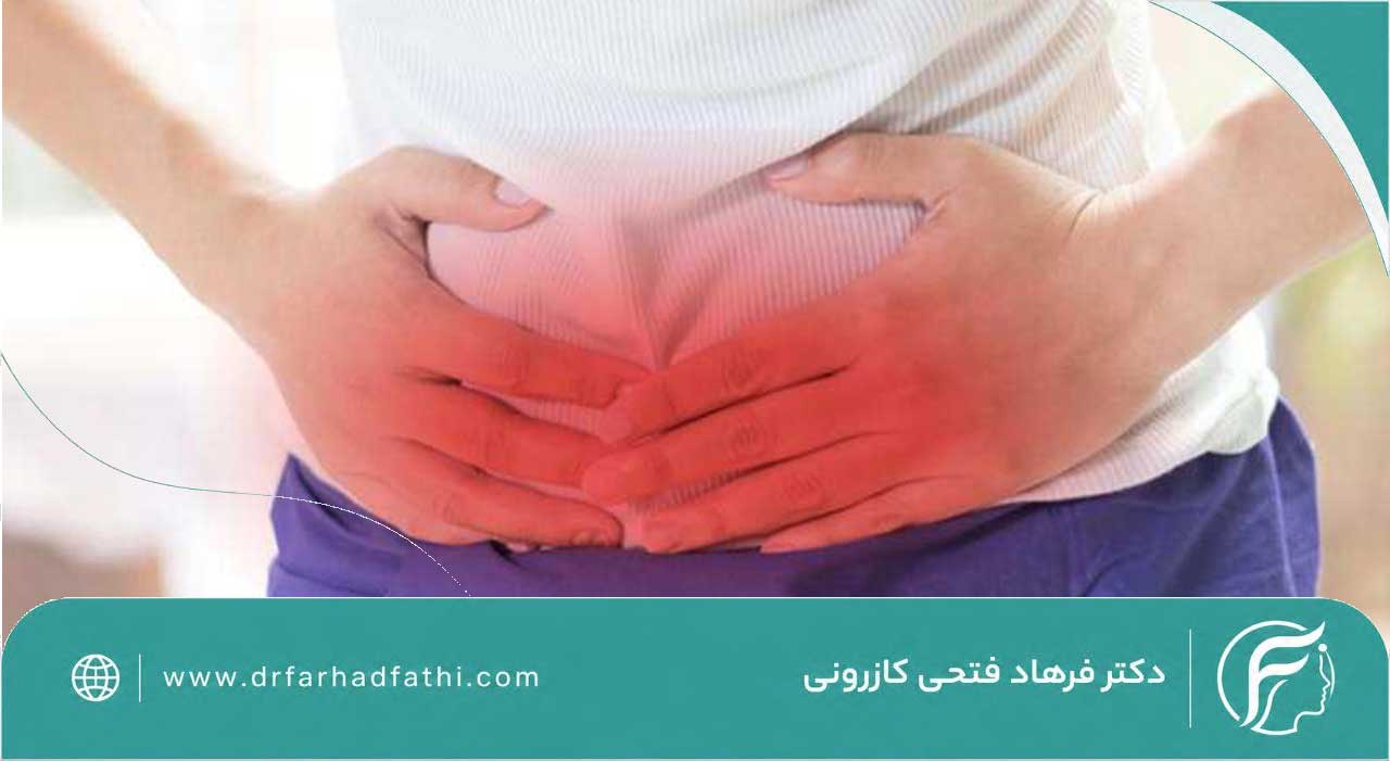 فتق شکم چیست