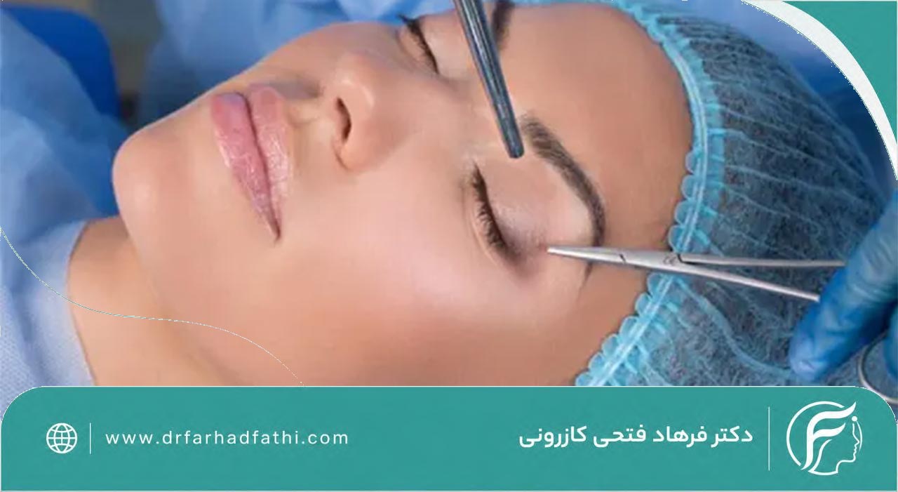 مراحل بلفاروپلاستی