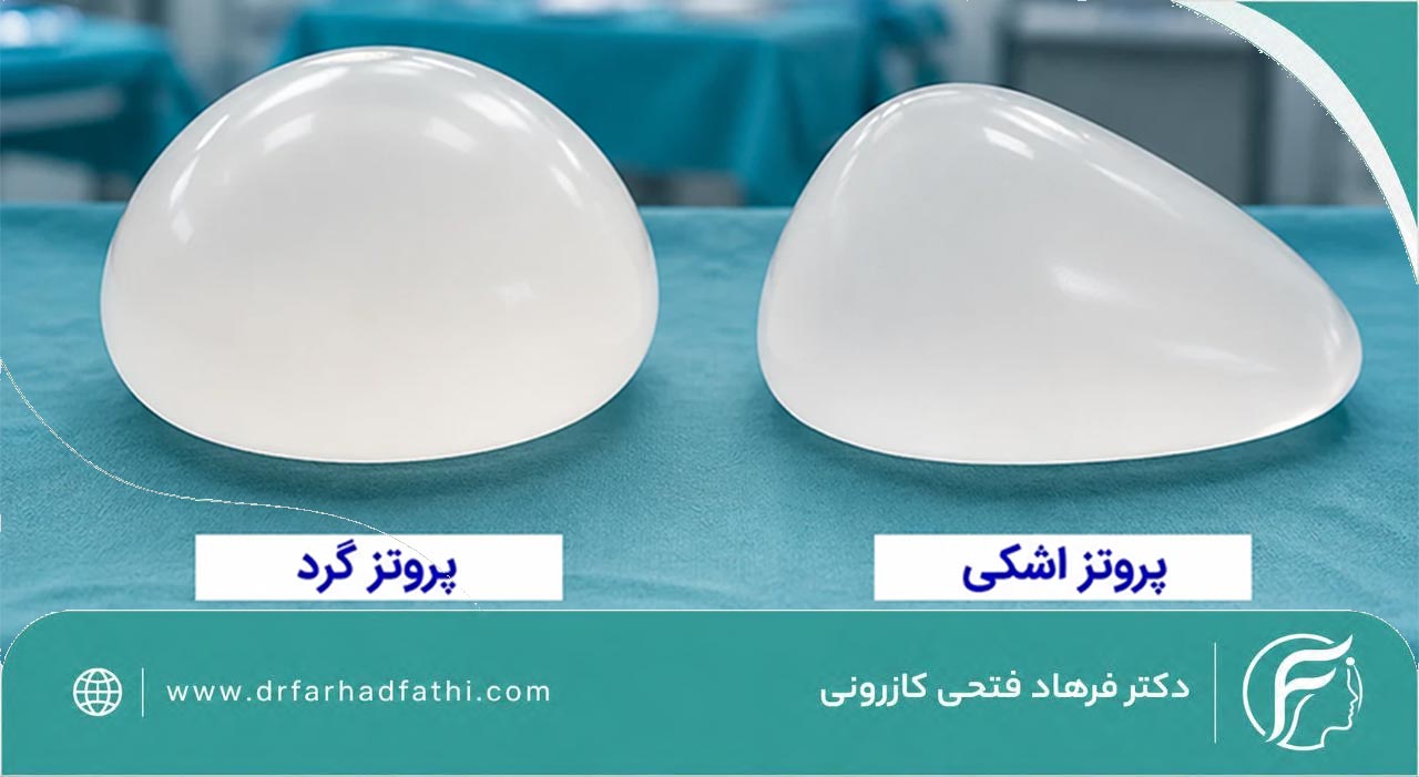 انواع پروتز سینه